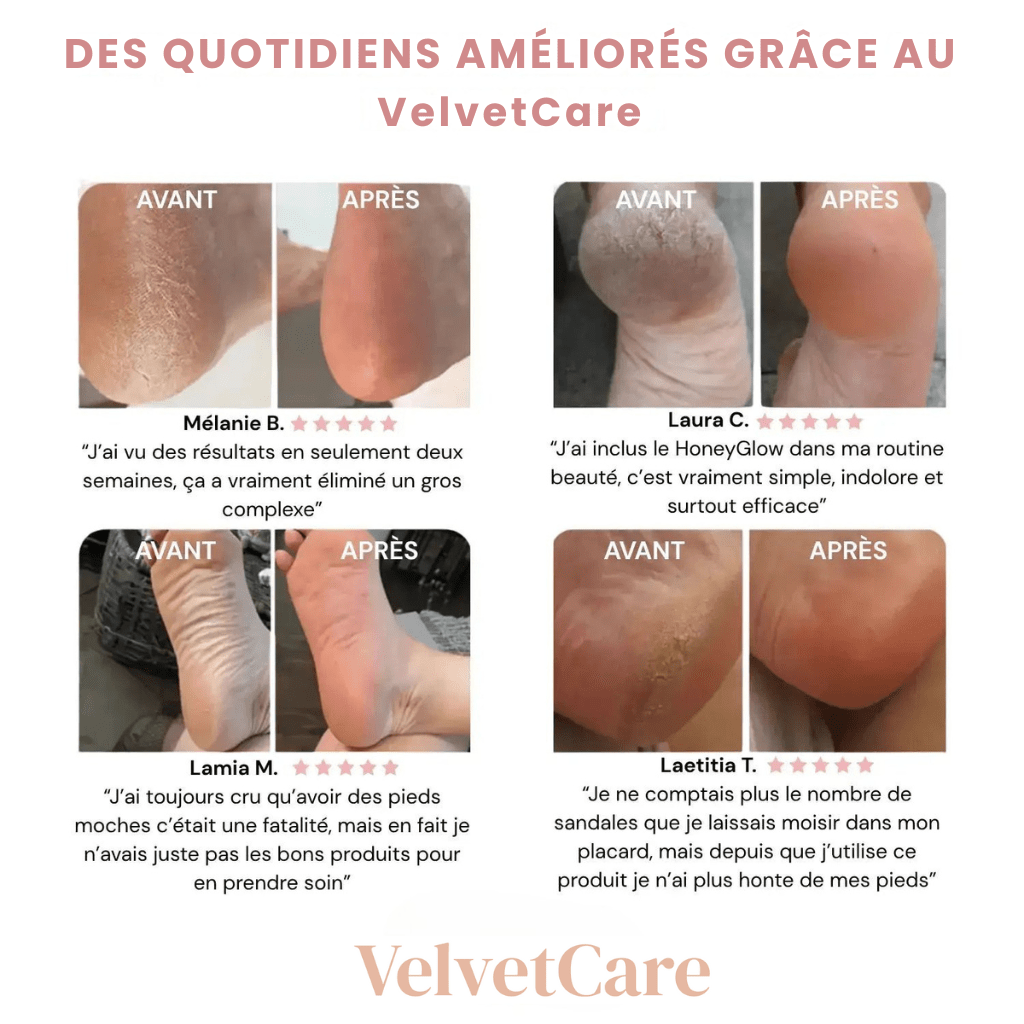 VelvetCare - Transforme et Sublime Vos Pieds - VelvetCare
