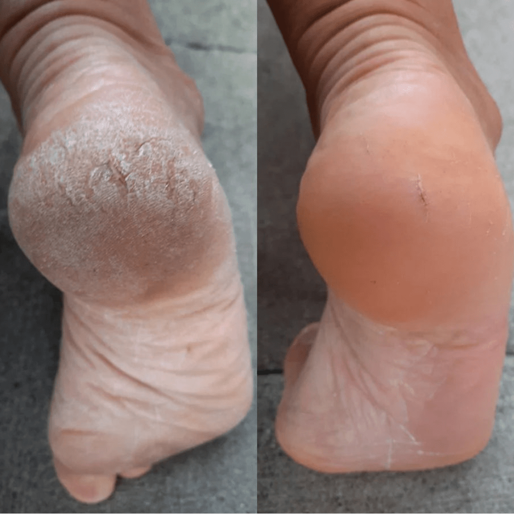 VelvetCare - Transforme et Sublime Vos Pieds - VelvetCare