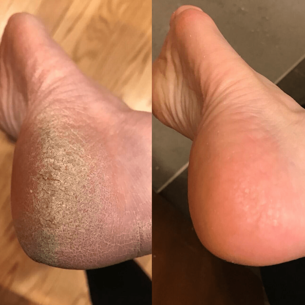 VelvetCare - Transforme et Sublime Vos Pieds - VelvetCare