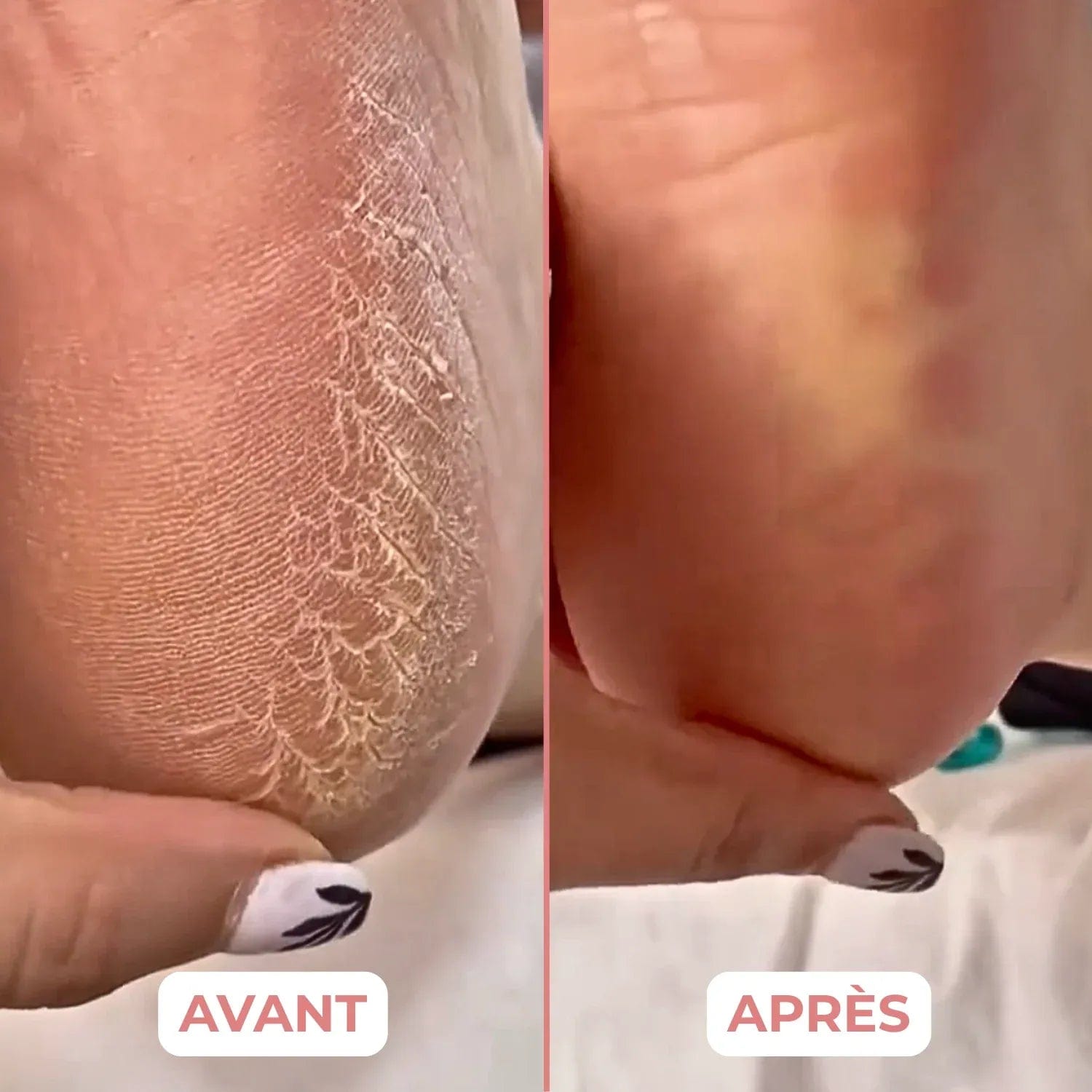 VelvetCare - Transforme et Sublime Vos Pieds - VelvetCare