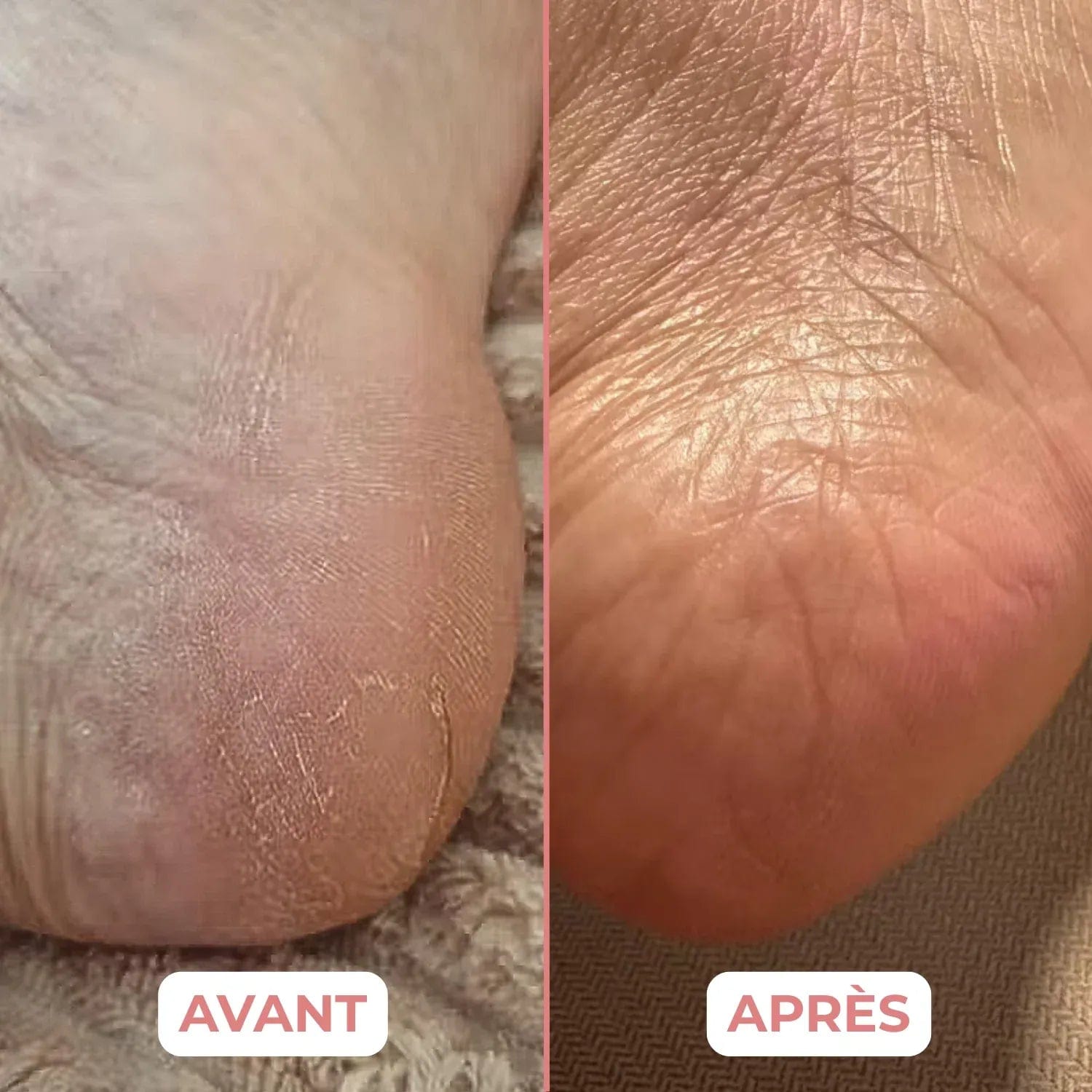 VelvetCare - Transforme et Sublime Vos Pieds - VelvetCare